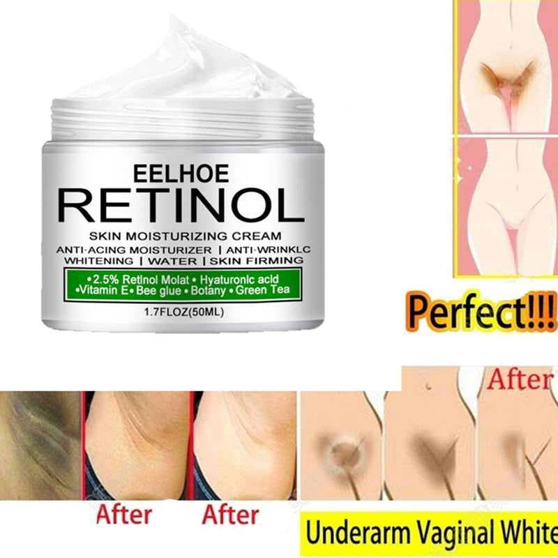 Armpit Body Whitening Cream Knee Underarm Buttocks Private Bleach Cream Remove Melanin Improve Dull Nourish Brighten Skin Care - Mike Armstrong